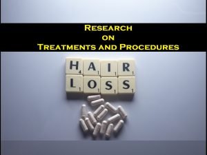 15-different-hair-loss-treatments-and-procedures-research